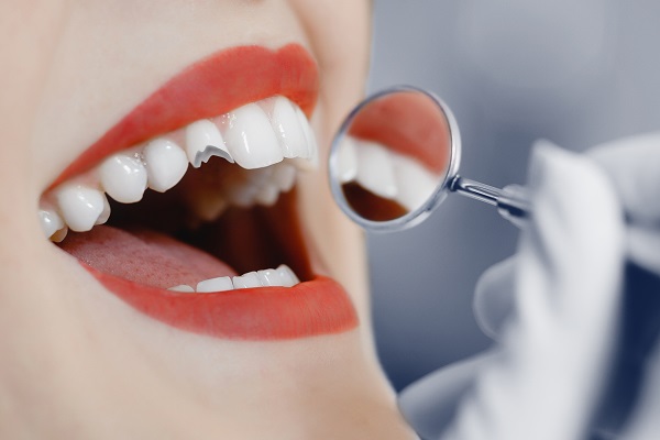 Get A Broken Tooth Treated To Avoid Complications