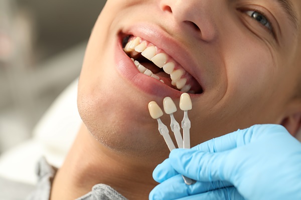 Myths About Dental Bonding