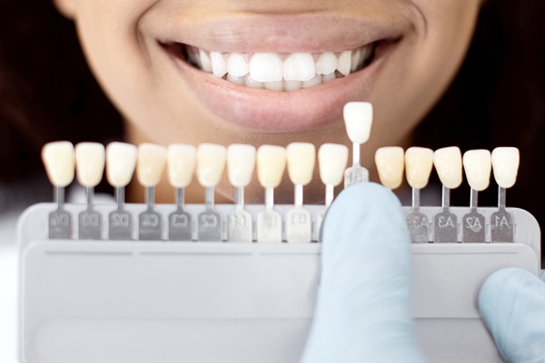 Is Dental Bonding An Option For Damaged Enamel?
