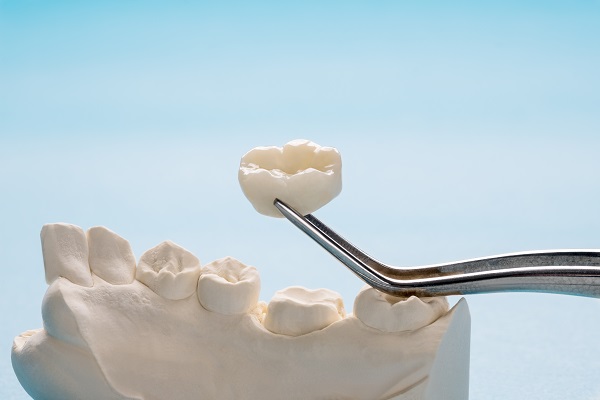 When Is A  Dental Crown Recommended?