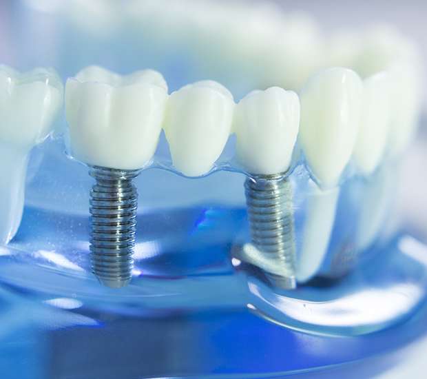 Chicago Dental Implants