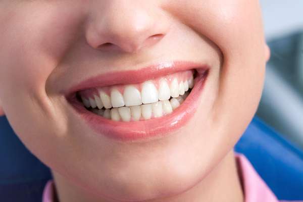 A General Dentist Discusses the Benefits of Tooth Straightening from Allure Dental in Chicago, IL