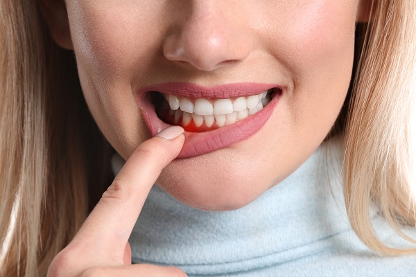 When Is Gum Disease Treatment Necessary?