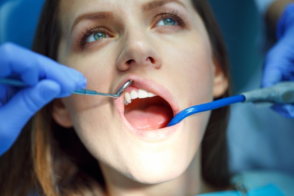 Reversing Gingivitis With Early Gum Disease Treatment