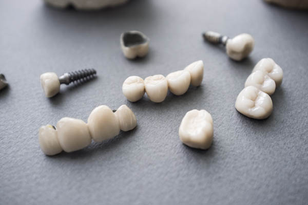 How Traditional Dental Crowns And Implant Crowns Differ