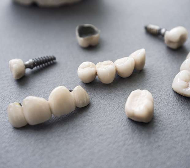 Chicago The Difference Between Dental Implants and Mini Dental Implants