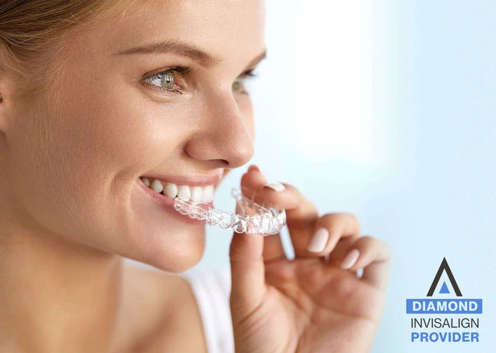 Invisalign