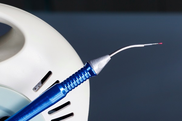 When Would Laser Dentistry Be Recommended?