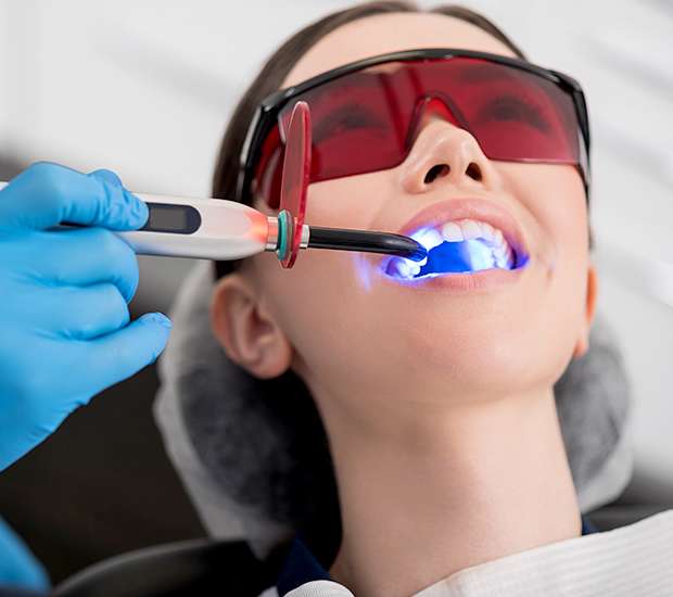 Chicago Professional Teeth Whitening